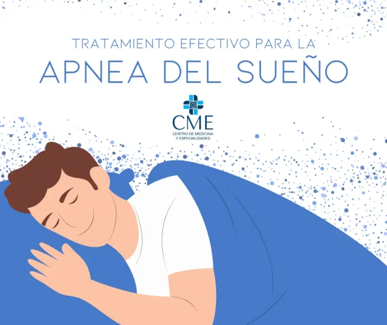 Apnea del Sueño, Cómo Diagnosticar y Tratar este Trastorno Respiratorio en CME